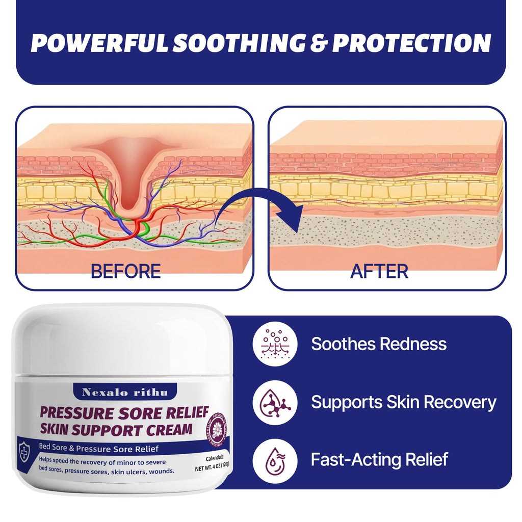 Calendula Aloe Vera Bed Sore Cream O56217