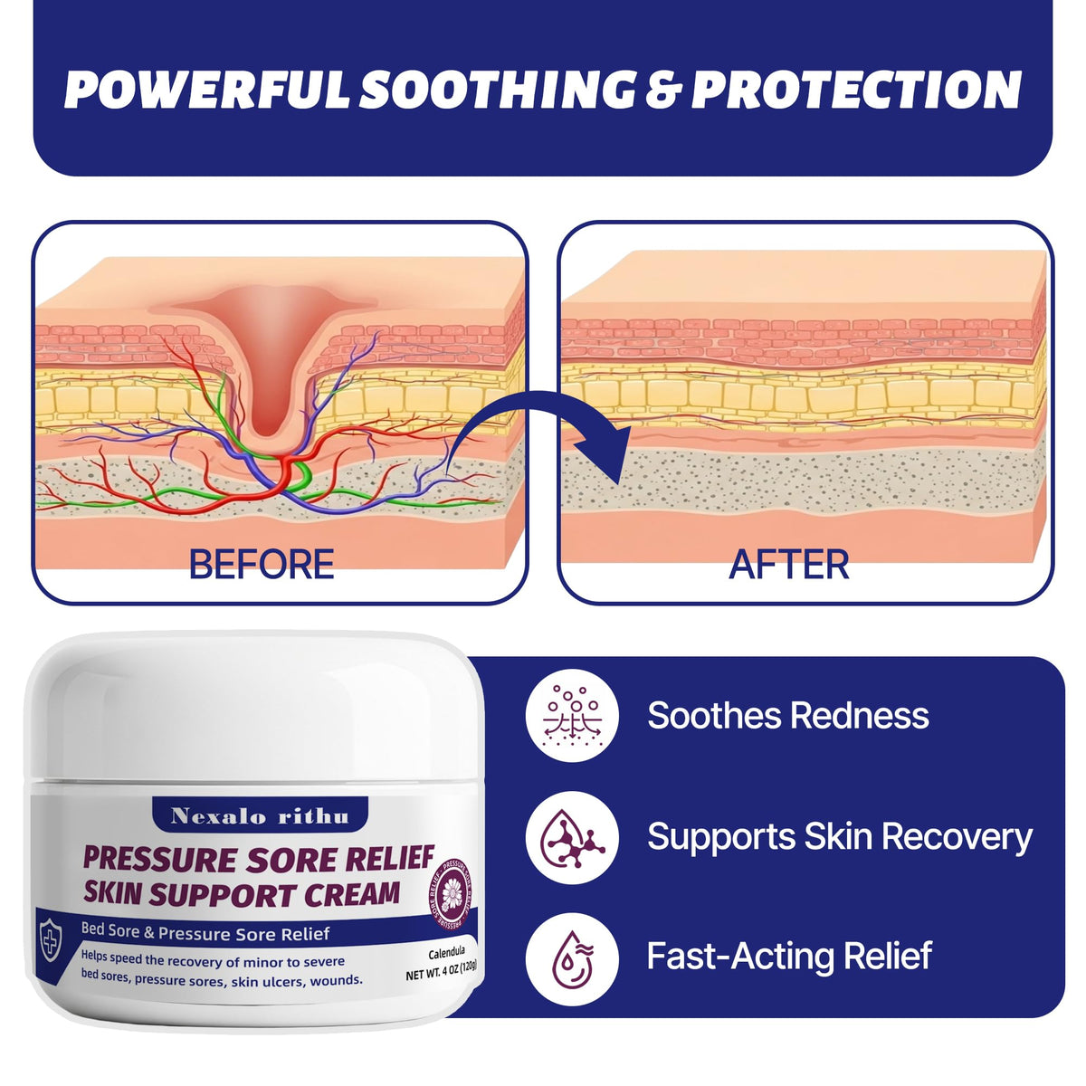 Calendula Aloe Vera Bed Sore Cream O56217
